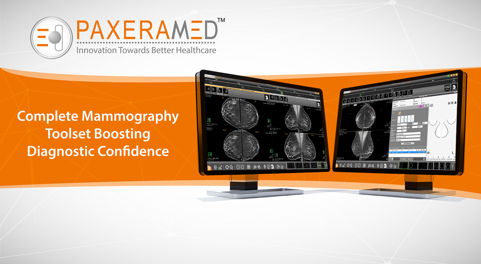 Complete Mammography Toolset Boosting Diagnostic Confidence